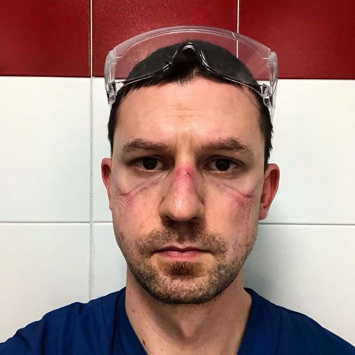 Acının izi yüzlerinde! Corona Virüs doktorlarından şaşırtıcı paylaşımlar...