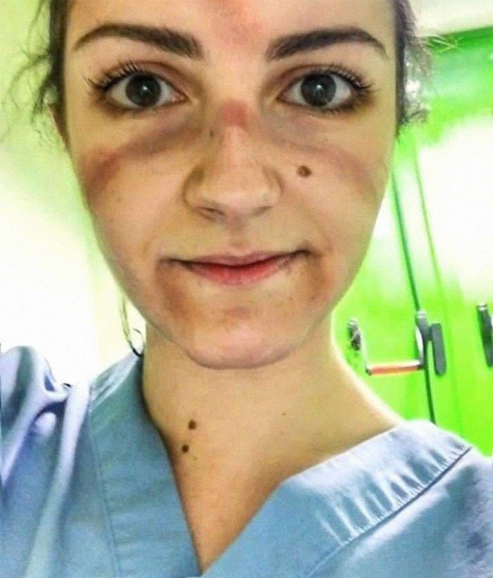 Acının izi yüzlerinde! Corona Virüs doktorlarından şaşırtıcı paylaşımlar...