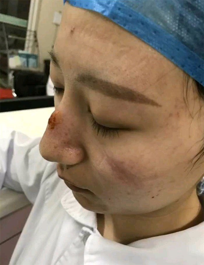 Acının izi yüzlerinde! Corona Virüs doktorlarından şaşırtıcı paylaşımlar...