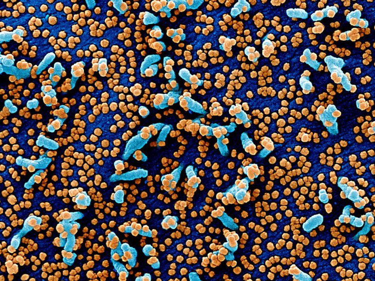 Coronavirüs Nasıl Görünüyor? Yeni Görüntüleri Yayınlandı
