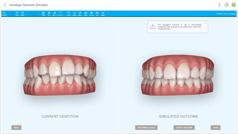COVID-19 ve Sonrasında Diş Tedavisi Nasıl Yapılmalı? Yenilikler Neler?